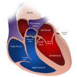 Stenoza aortică